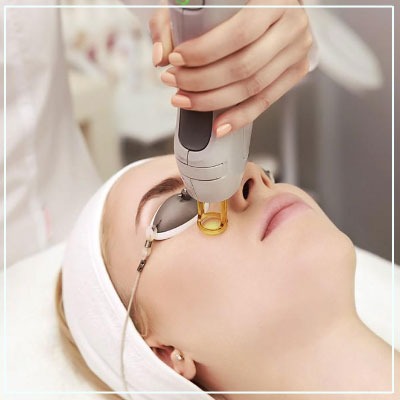 CO2 Laser Treatment in Mumbai