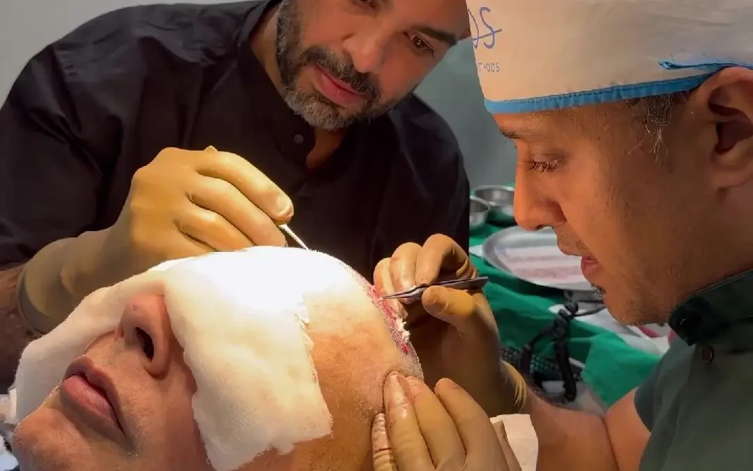 Hair Transplant in Mumbai: A Complete Guide to Hair Restoration