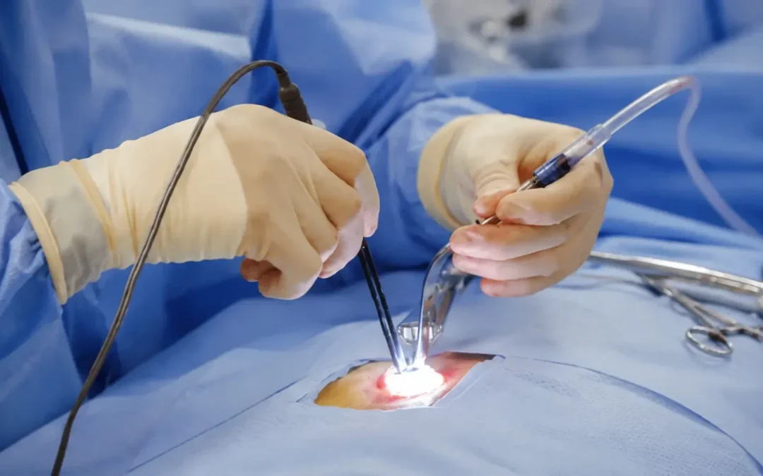 Minimally Invasive Spine Surgery in Mumbai: Advanced Spine Care by Dr. Manish Baldia