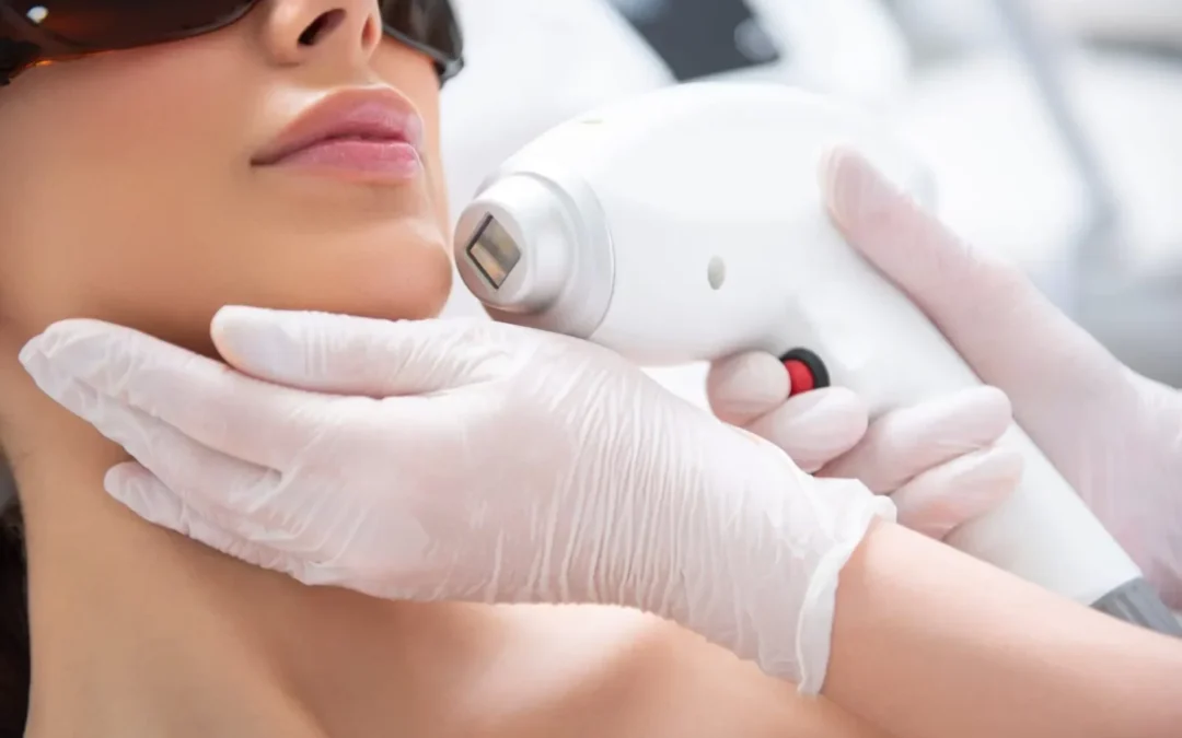Face Laser Treatment: A Safe and Effective Solution for Long-Term Facial Hair Reduction