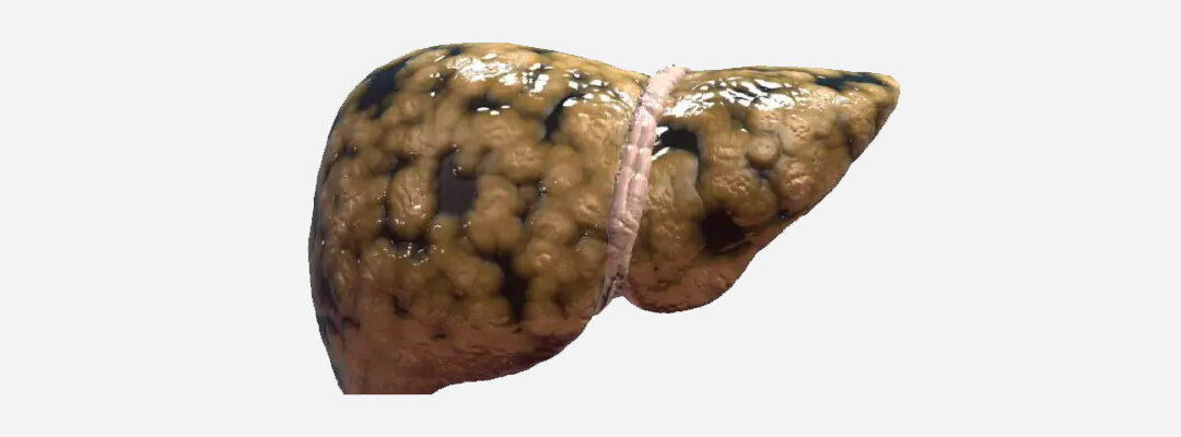 Liver Specialist in Mumbai – Comprehensive Liver Care with Dr. Vedant H. Karvir