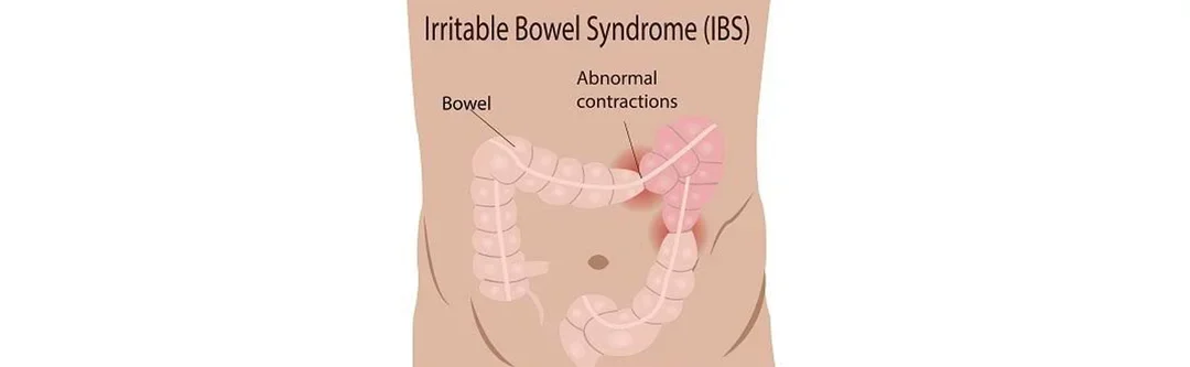 IBS Treatment in Mumbai: Understanding Symptoms, Diagnosis and Care