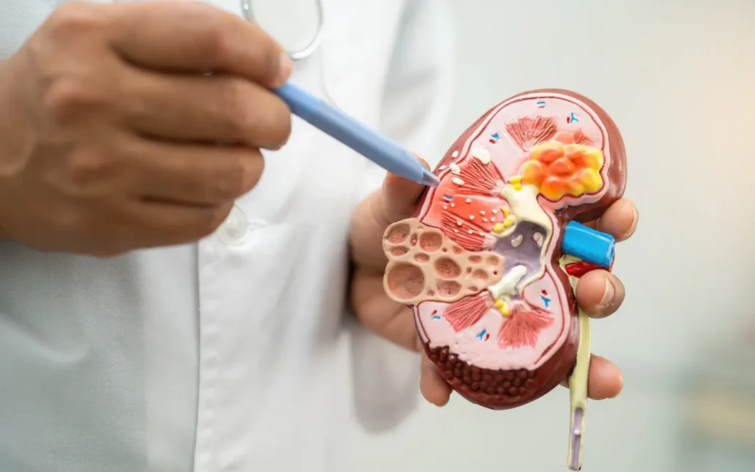 Robotic Partial Nephrectomy in Mumbai: Kidney-Sparing Surgery with Dr. Vivek Venkat